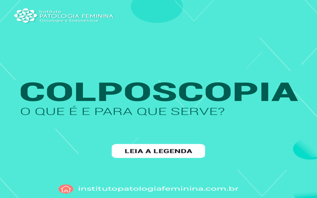 Colposcopia: O Que É E Para Que Serve?